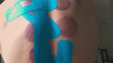 Erkek Atletizm ve Kinesio Kaset Spor Masajı ve Süpürge Terapisi. Sırt ağrısını tedavi etme kavramı. Omurga hastalıkları. Kemik erimesi, fıtık, omurga eğriliği. Yavaş Hareket,