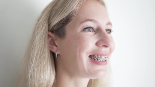 Beautiful Young Woman Braces Her Teeth Smiles Close Slow Motion — Video Stock