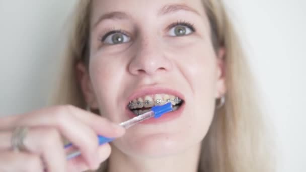 Close Face Woman Brushing Her Teeth Braces Brush Oral Hygiene — Video Stock