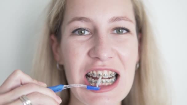 Oral Hygiene Braces Woman Cleans Her Teeth Panicle Braces Small — Stockvideo