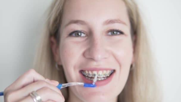 Зуби Брекети Чищення Крупним Планом Жіноче Чищення Міжзубної Зубної Щітки — стокове відео