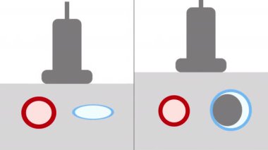 Animation Showing Ultrasound Compression for Detecting of Deep Vein Thrombosis of Legs Including Normal and Abnormal Finding