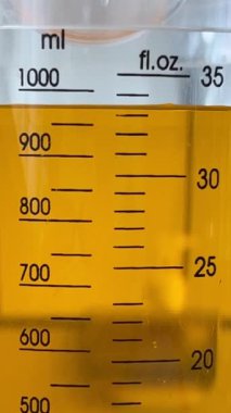 Oral rehidrasyon çözeltilerinin Pitcher 'daki yakın görüntüsü. İshal hastaları için hazırlanıyorum. Dikey Görüntü