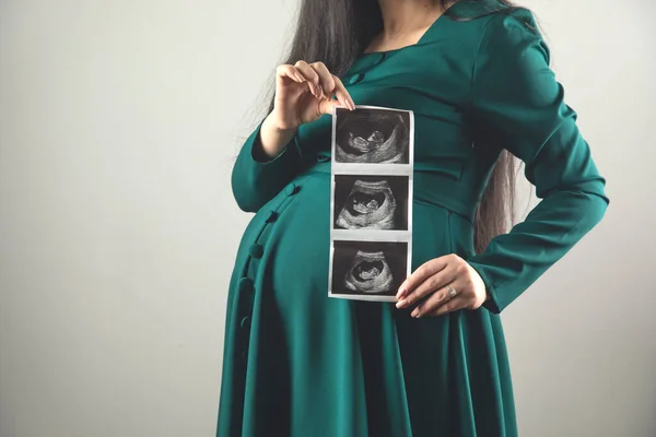 Těhotná Žena Ruka Ultrazvuk Obrázek Dítěte — Stock fotografie