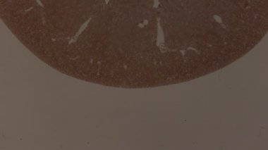 Mikroskop altında böbrek dokusu 100x