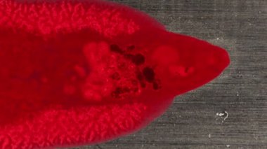 Darkfield 'daki büyüteçin altında büyük bir karaciğer akışı var.