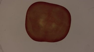 Diş, diş çürük dokuyu mikroskop altında çürütür.