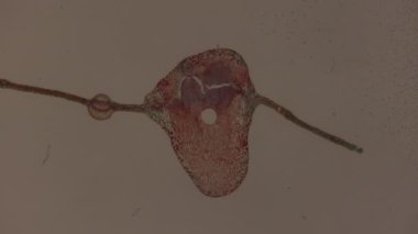 Ağlayan söğüt, mikroskop altında yaprak safra dokusu