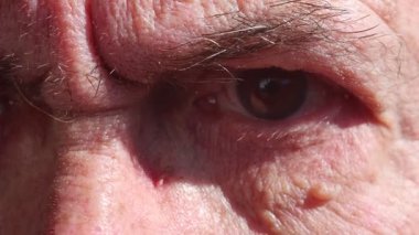 Kahverengi gözler ve beyaz sarmaşıklar