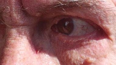 Kahverengi gözler ve beyaz sarmaşıklar