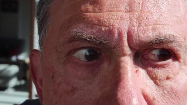 Kahverengi gözler ve beyaz sarmaşıklar