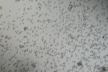 Mikroskop altında hifae ve küf sponsorları olan tehlikeli kafa kalıbı 200x