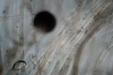 Mikroskop altında hifae ve küf sponsorları olan tehlikeli kafa kalıbı 200x