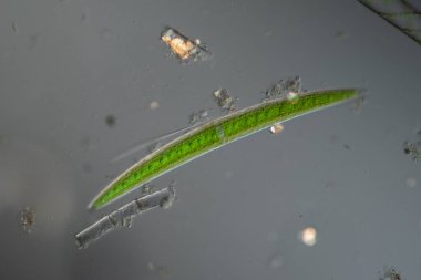 Mikroskop altında su damlalarında yeşil yosunlar. 100 kat daha fazla.