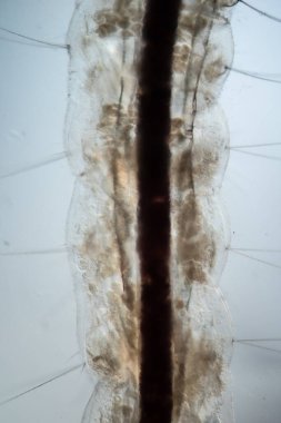 Sivrisinek larvası mikroskobun altında 50 kat fazla yüzer.