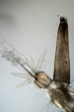 Sivrisinek larvası mikroskobun altında 50 kat fazla yüzer.