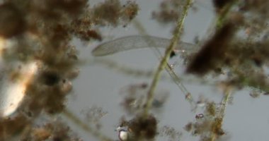 Bataklık solucanı atık suda 50 kat daha fazla mikroskop altına düşüyor.