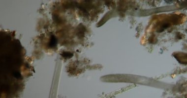 Bataklık solucanı atık suda 50 kat daha fazla mikroskop altına düşüyor.