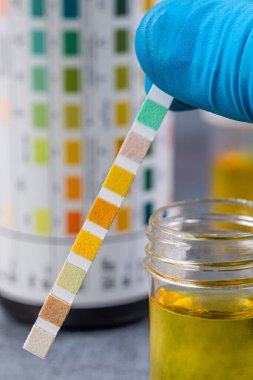 İdrar testi, kendini ölçme.