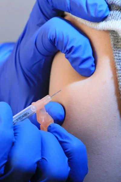 Vacinação Visão Close Criança — Fotografia de Stock
