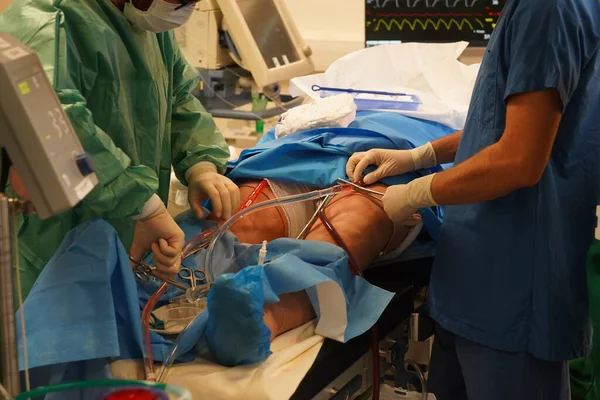 Treinamento Estagiários Médicos Técnica Ecmo Oxigenação Membrana Extracorpórea — Fotografia de Stock