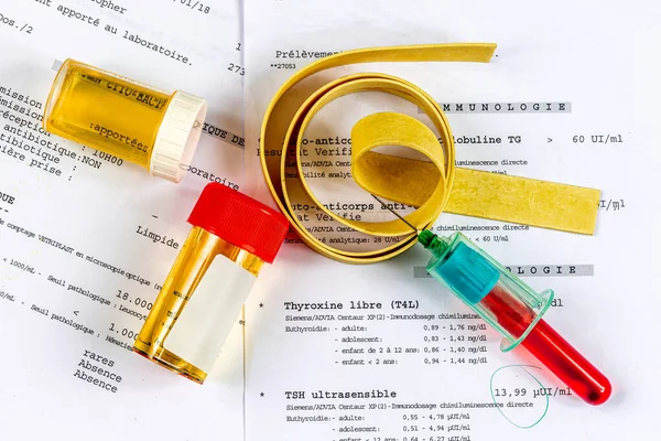 Tourniquet Sample Body Urine Vials Placed Test Results — Stock Photo, Image
