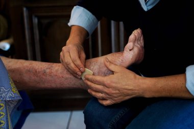 Liberal hemşire yaşlı birini ziyaret ediyor. Bacakları ve küçük yaraları iyileştir..