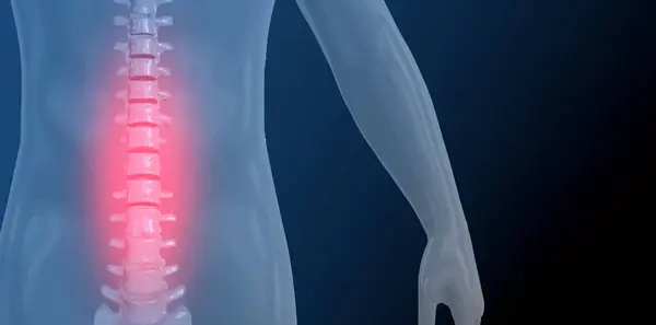 3d render of the spine with back pain