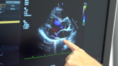Hastalara ekokardiyogram testi için yeni bir ultrason cihazı olan kardiyoloji kliniği ve monitöre bakan kadın doktor.