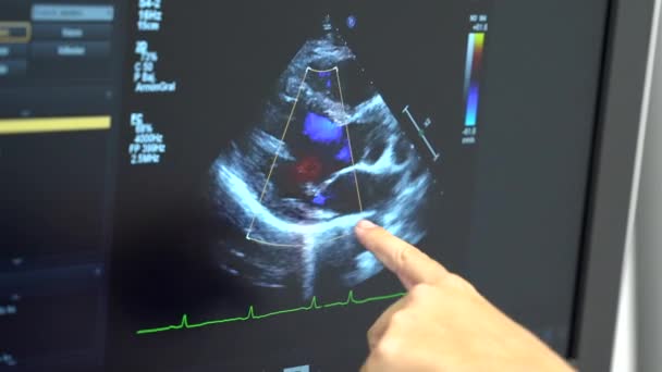 顧客へのエコーディオグラム試験のための新しい超音波機械が付いている心臓病クリニック モニターを指す女性の医者 — ストック動画