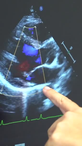 Clínica Cardiología Con Una Nueva Máquina Ultrasonido Para Exámenes Ecocardiograma — Vídeo de stock
