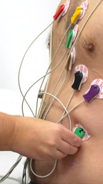 两名心脏科医生将电极放置在病人身上进行心血管压力测试的特写照片 — 图库视频影像