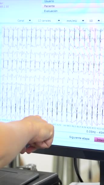 Cardiólogo Señalando Los Datos Ordenador Mientras Hombre Realiza Una Prueba — Vídeo de stock