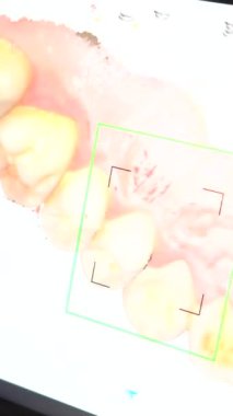 Diş sağlığı kliniği, yalancı hastanın 3 boyutlu taramasını yapan dişçinin ayrıntıları.