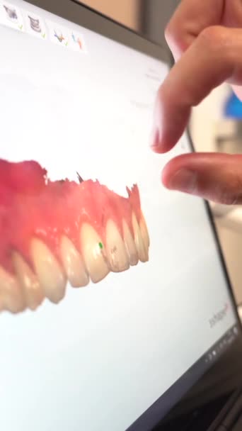 Врач Стоматологической Клинике Объясняет Смотрит Рентгена Компьютере — стоковое видео