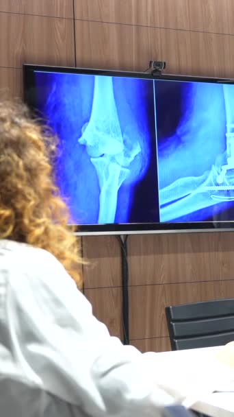 Doktorlar Travmatoloji Toplantı Odasında Kalça Röntgenlerine Bakıyorlar — Stok video