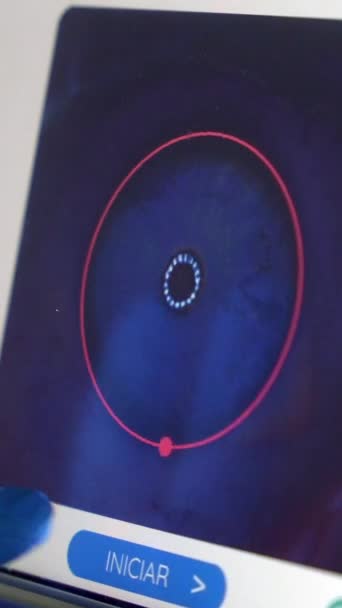 Экран Используемый Офтальмологом Наблюдения Применением Лазера Лечении Глаукомы Пациента — стоковое видео