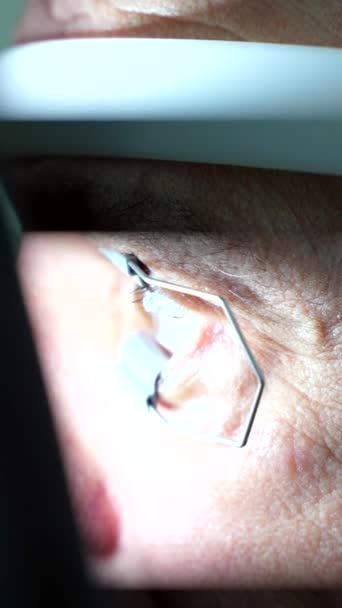 Foto Close Homem Idoso Recebendo Tratamento Laser Para Glaucoma Uma — Vídeo de Stock