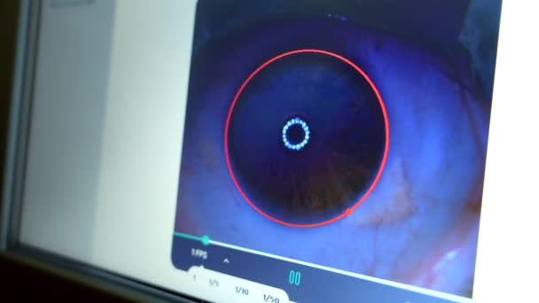 Göz Doktoru Tarafından Glokom Tedavisi Sırasında Lazer Uygulamasını Gözlemlemek Için — Stok video