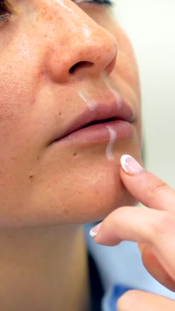 ヒアルロン酸を注入する唇の点を印を付ける審美的な医者 — ストック動画