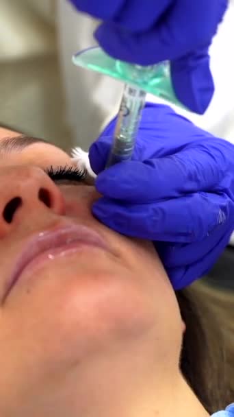 医生注射透明质酸注射到一个女人的脸上在一个年轻化的美容过程中 — 图库视频影像