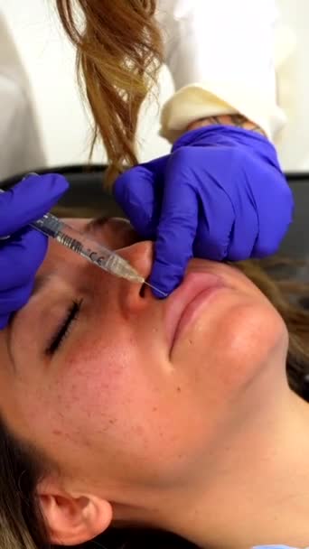 Klinikteki Hyaluronik Asitle Yüz Gençleştirme Tedavisi Sırasında Sedyede Gözleri Kapalı — Stok video