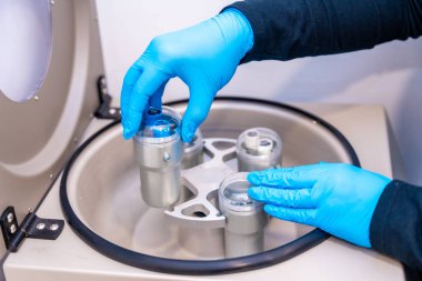 Bir dermatoloji laboratuarındaki sağlık çalışanının ellerinin üst görüntüsü. Test tüplerine santrifüj için kan örnekleri yerleştiriyor.