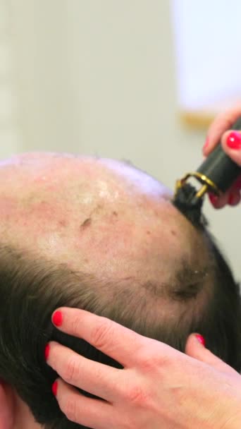 Penata Rambut Mencukur Kepala Seorang Pria Botak Untuk Memasang Wig — Stok Video