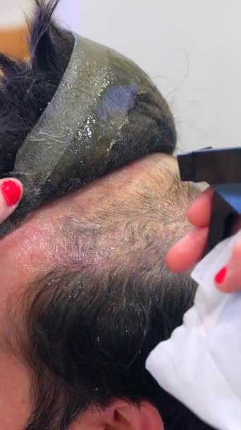 Tampilan Belakang Close Dari Penata Rambut Menghapus Prostesis Kapiler Dari — Stok Video