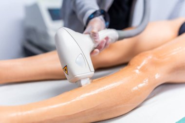 Modern lazer tedavisi sırasında güzellik kliniğinde bir kadının bacağı.