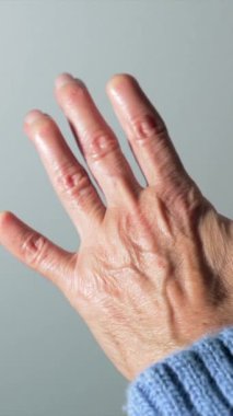 Yaşlı bir kadın, beyaz arka planda izole edilmiş, romatizma yüzünden deforme olmuş elini gösteriyor.