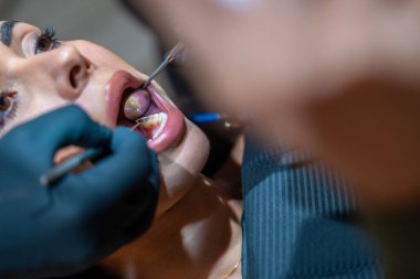 Diş hekimi, diş aynası kullanarak siyah eldiven takıyor ve dişçi muayenesi sırasında hastanın dişlerini inceliyor.