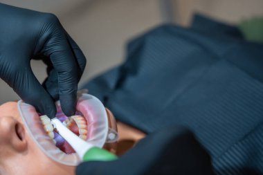 Siyah eldiven giyen dişçi hastanın dişlerini beyazlatmak için retraktör ve özel elektrikli fırça kullanıyor.