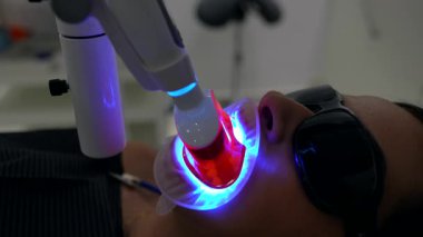 Hassas diş lazeri beyazlatma prosedürü ileri teknoloji ile hastanın ağzını aydınlatmak, oral estetiği ve profesyonel diş tedavisini geliştirmek